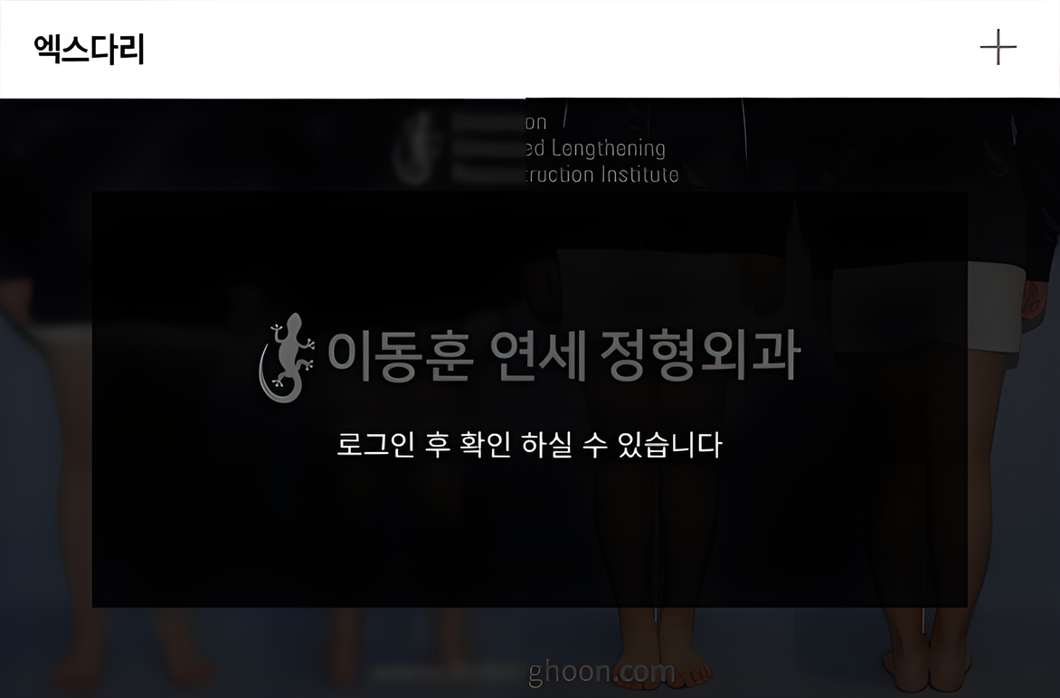 엑스다리 전후사진