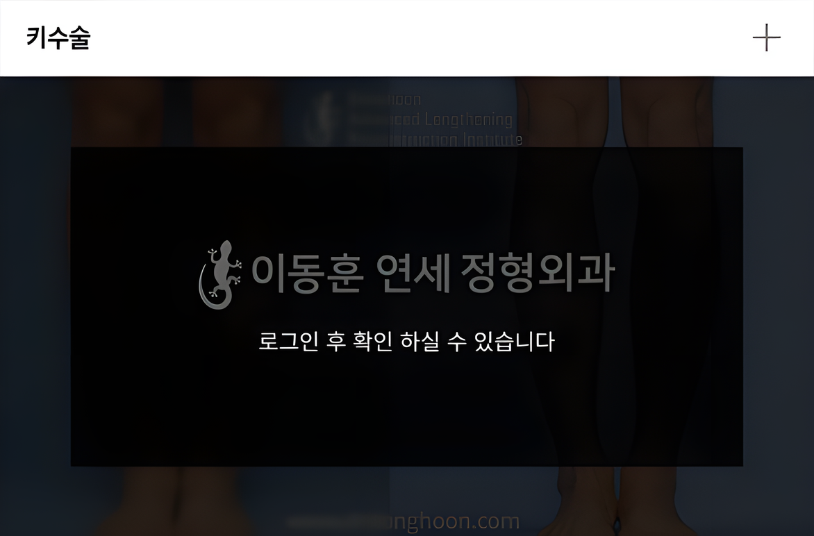 키수술 전후사진