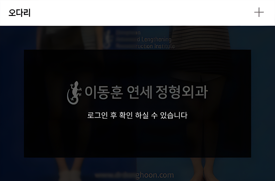 오다리 전후사진